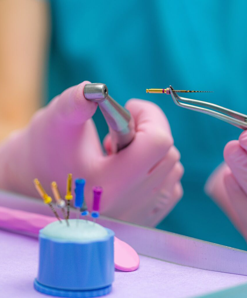 Endodontia - cabinet stomatologic Smile Architects