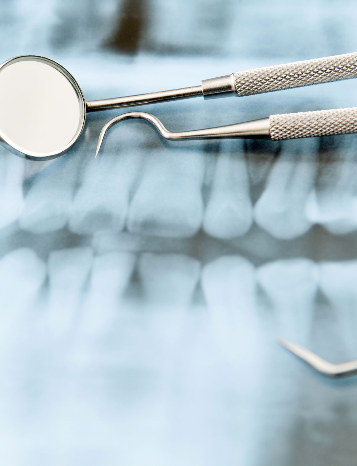 consultatia stomatologica - cabinet stomatologic Smile Architects