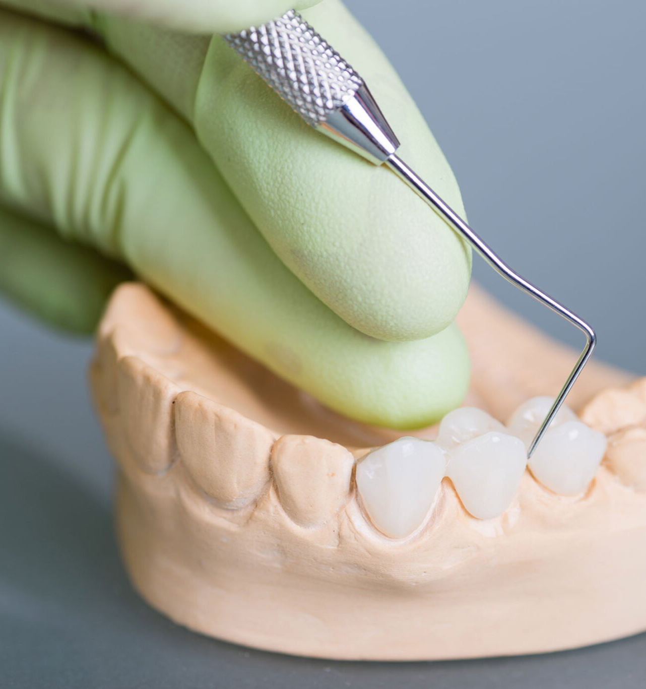 Protetica cabinet stomatologic Smile Architects