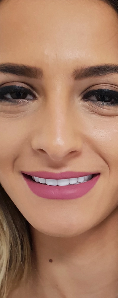 Andreea - Smile Architects, cabinet stomatologic